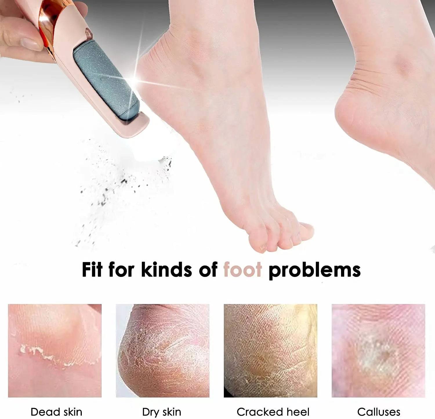 Electric Foot File Callus Remover | Hills Trimmer