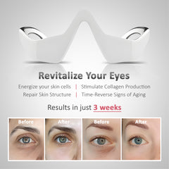 RadiantEyes™ - Medical Grade Under-Eye Red Light Therapy & Microcurrents