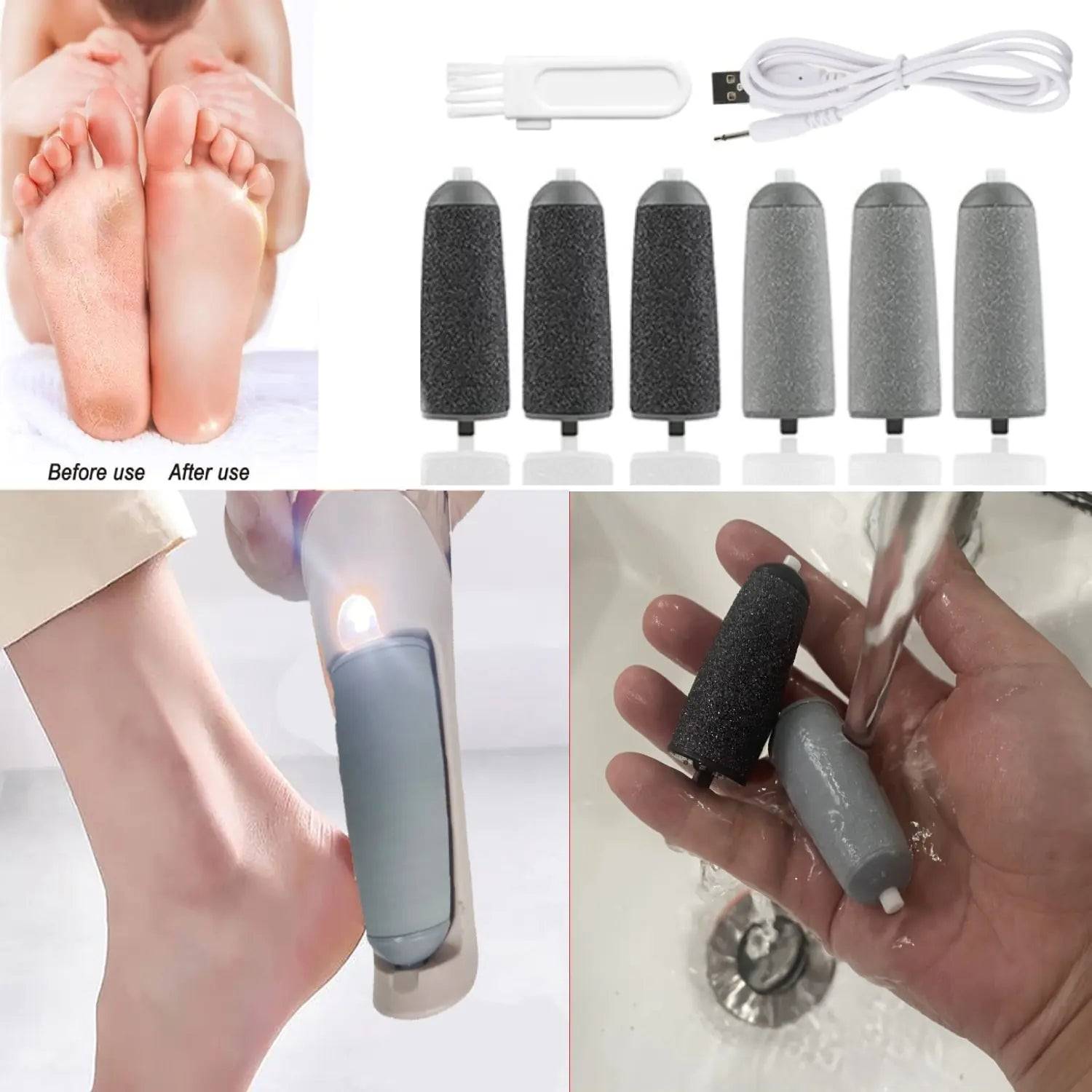 Electric Foot File Callus Remover | Hills Trimmer